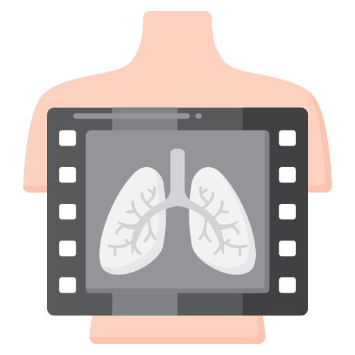 X-Ray